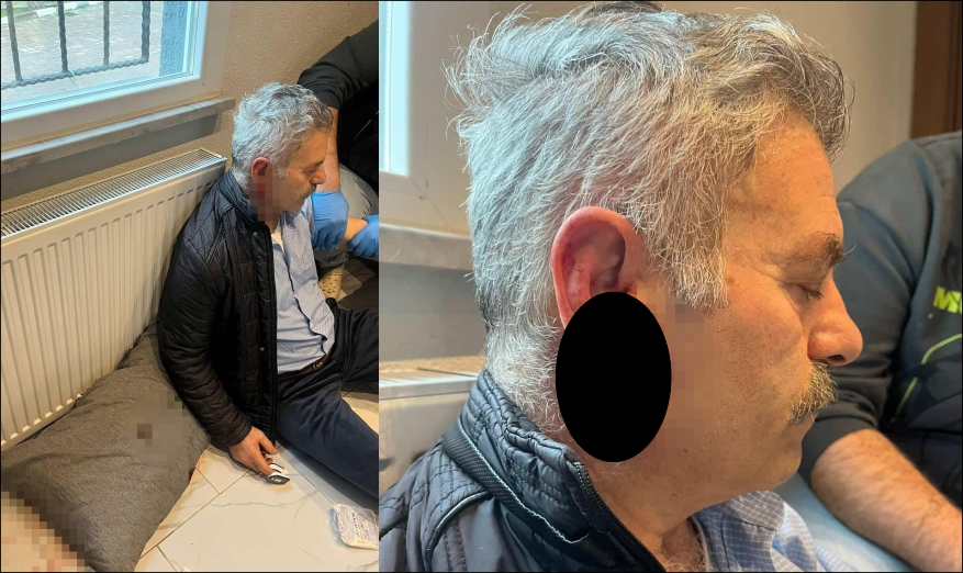 Bakım merkezine çağrılan eski çalışan darbedildi