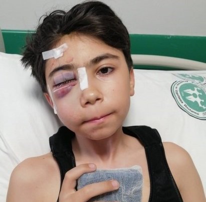 İhmalkarlık 13 yaşındaki çocuğun hayatını kararttı