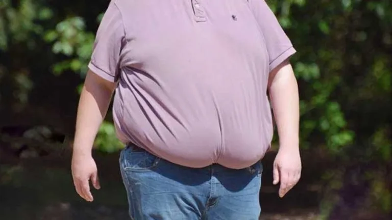 Toplumumuzun yüzde 50'si kilolu