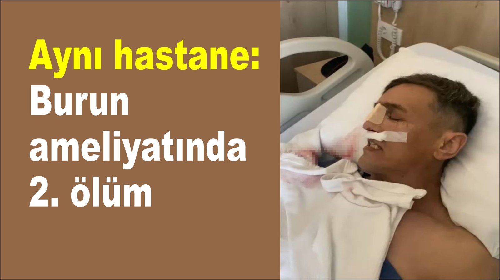 Aynı hastane: Burun ameliyatında 2. ölüm