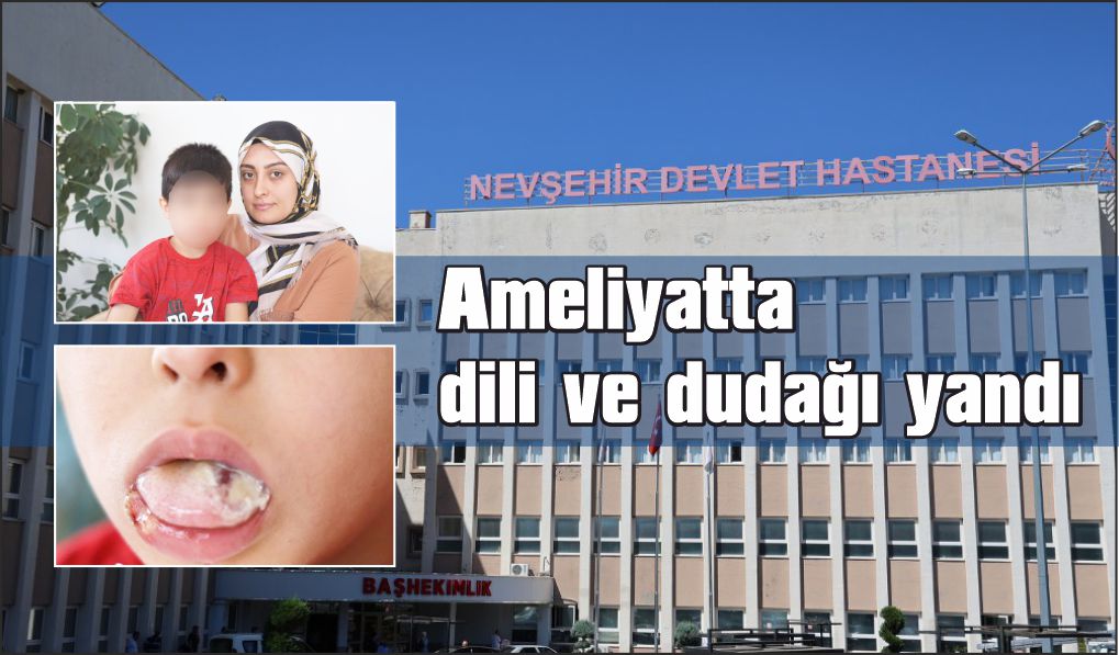 5 yaşındaki çocuğun ameliyatta dili ve dudağı yandı