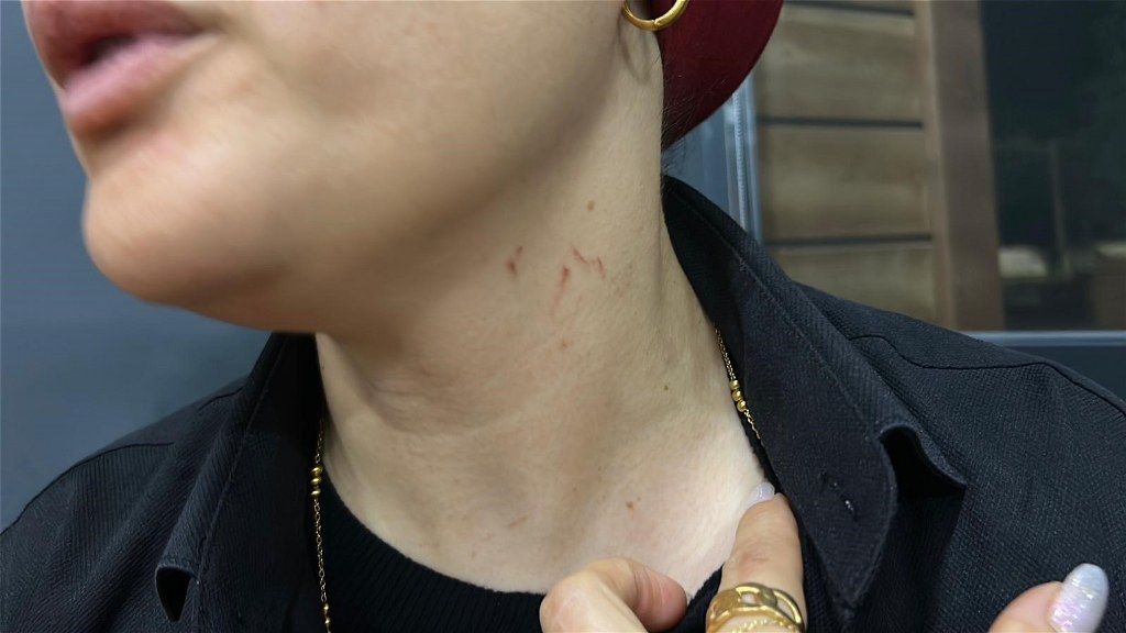 Halay başı olmak isteyen alkollü şahıs kadın soliste saldırdı