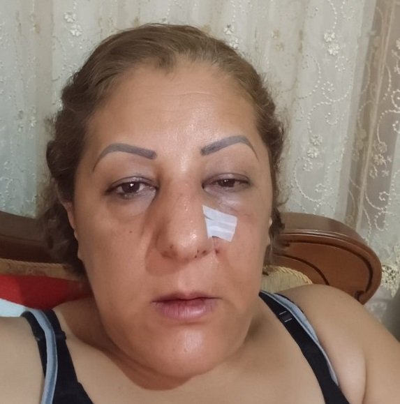 Kedi beslediği için darbedip burnunu kırdılar