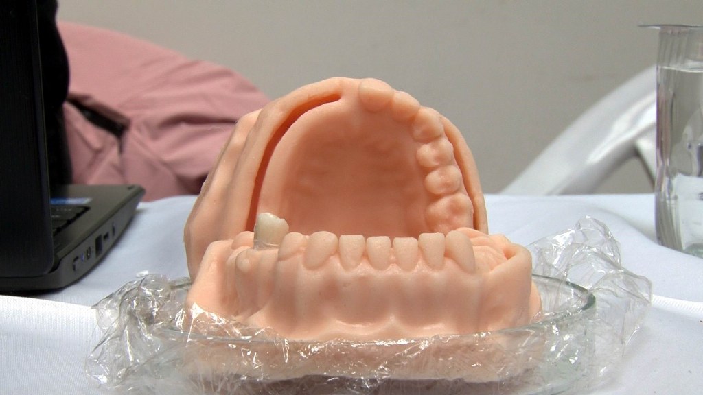 Liseliler balık pulundan organik ‘diş dolgusu’