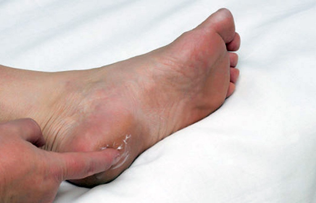 Topuk dikeni uyarısı: 