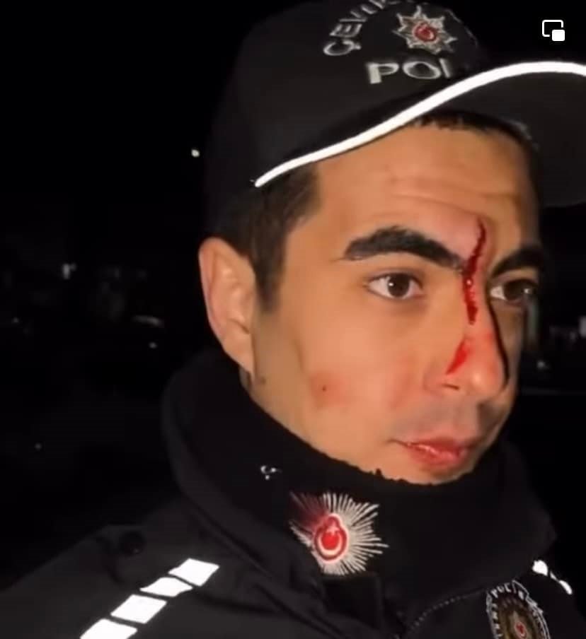 İzinsiz yürüyüşe müdahale eden polise saldırı, 2 gözaltı