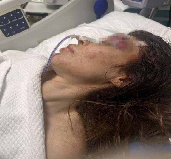 İş görüşmesine giden kadına boks hocasından bıçaklı ve yumruklu saldırı