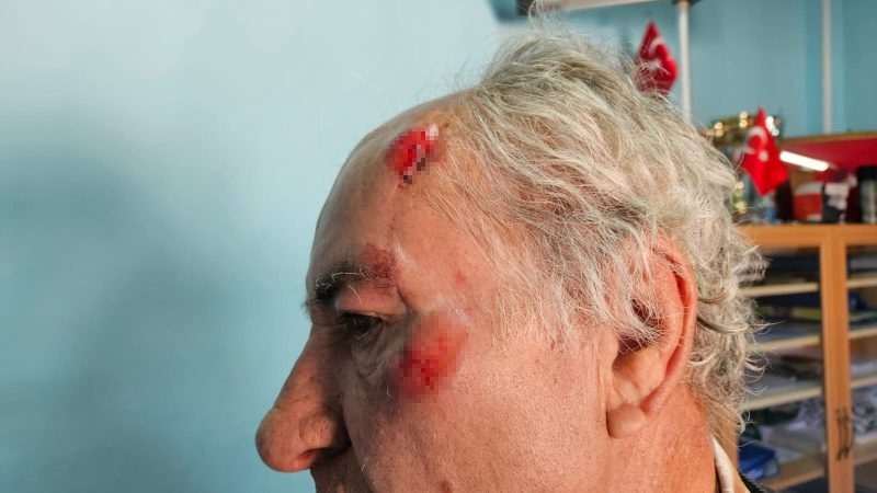 Salda’da köpeklerin saldırısına uğrayan yaşlı adam yaralandı