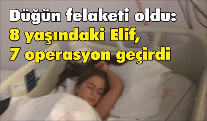 Düğün felaketi oldu: 8 yaşındaki Elif, 7 operasyon geçirdi