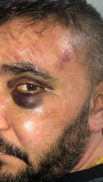 İşyeri sahibi dükkanında darp edildi